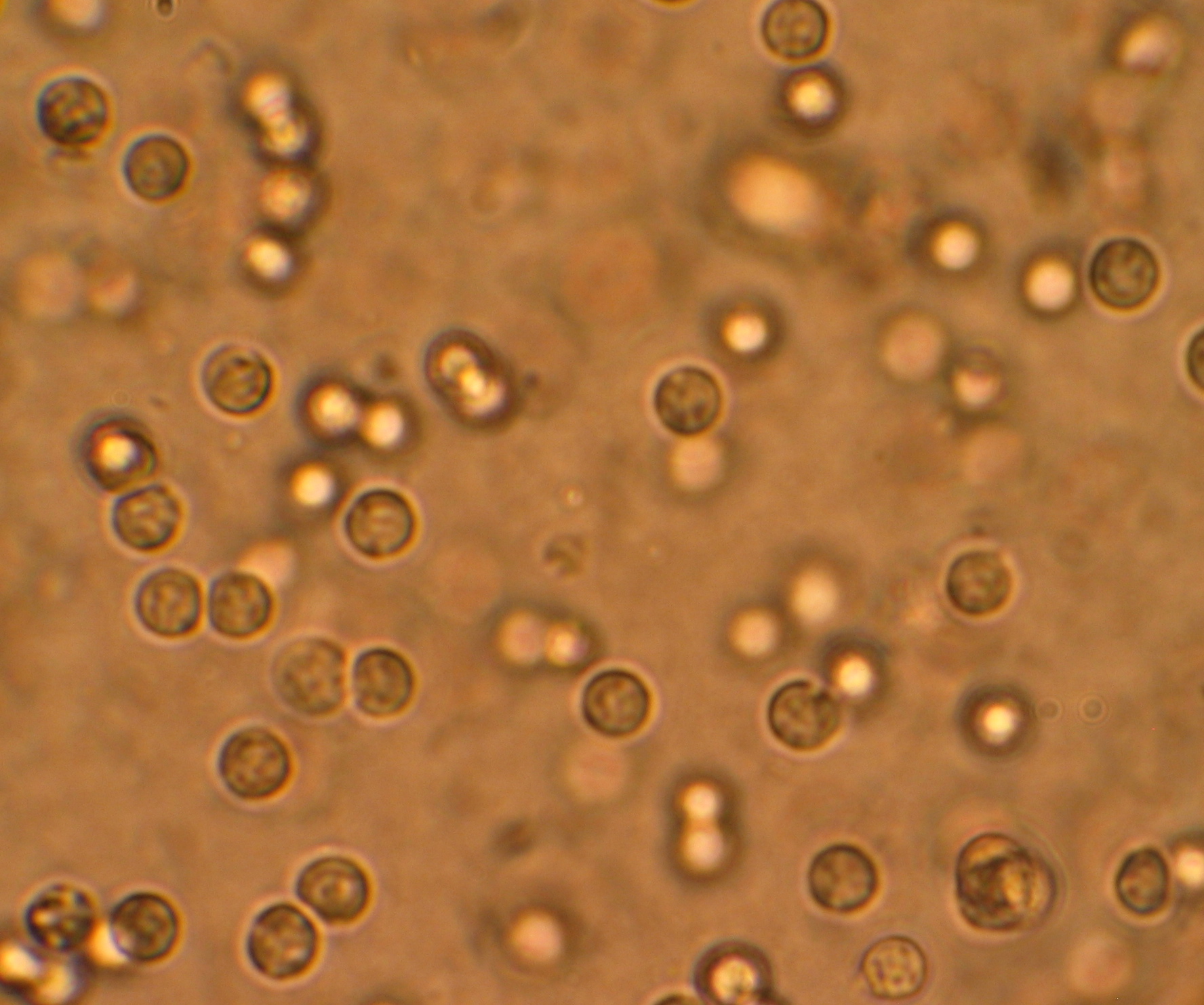 Imagem de referência de infecção do trato urinário, descrito nos dados abertos como infeção que afeta parte do trato urinário